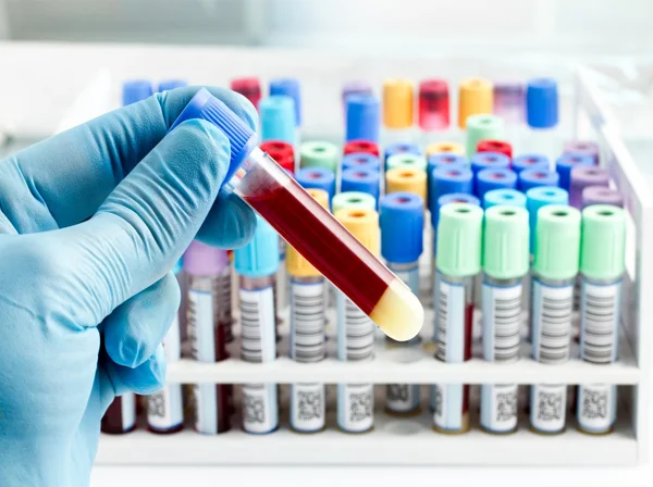 Lab Investigation