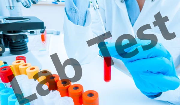 Lab Investigation